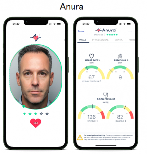 Anura